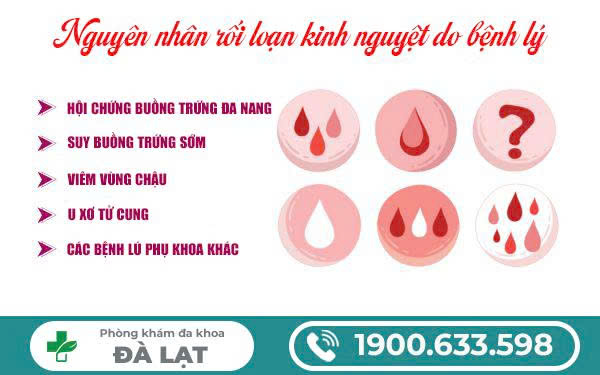 Hình ảnh minh họa